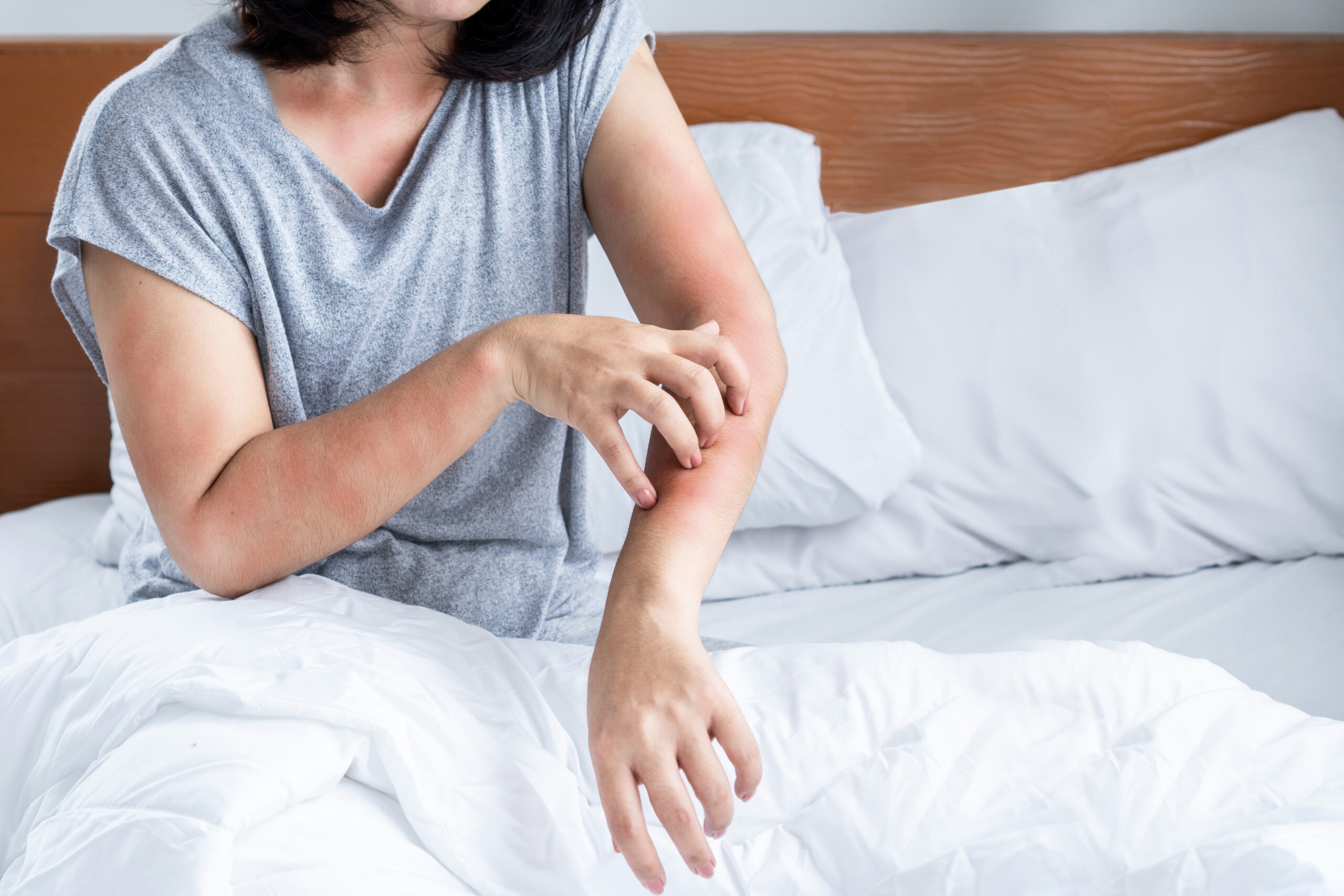 Lutter contre les punaises de lit